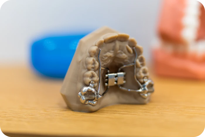 Modèle dentaire équipé d'un disjoncteur orthodontique